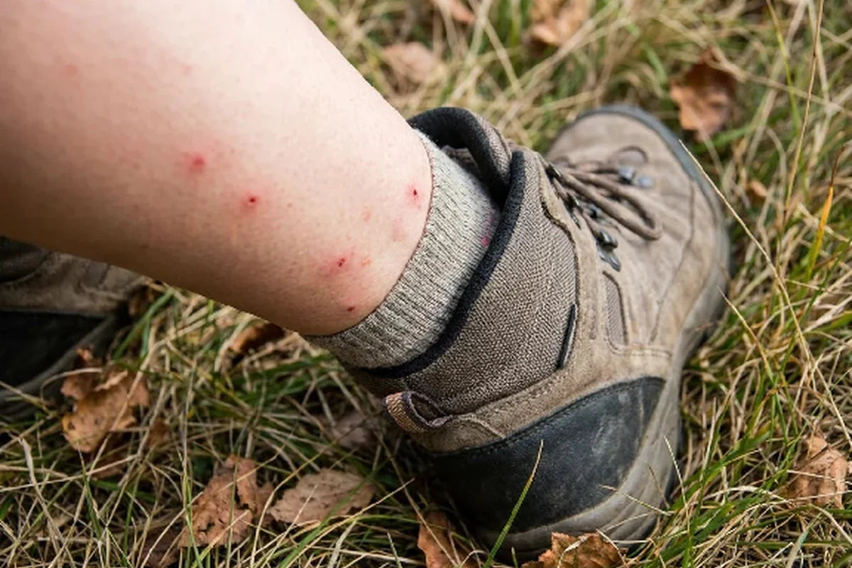 insect bite marks